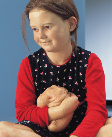 Patricia Piccinini Still Life With Stem Cells (detail), 2002; silicone, polyurethane, clothing, human hair; variable; enquire